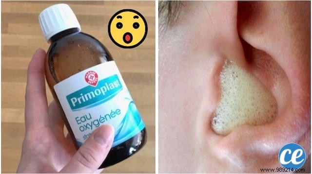 20 Proven Uses for Hydrogen Peroxide: Clean, Disinfect, and Heal Effectively