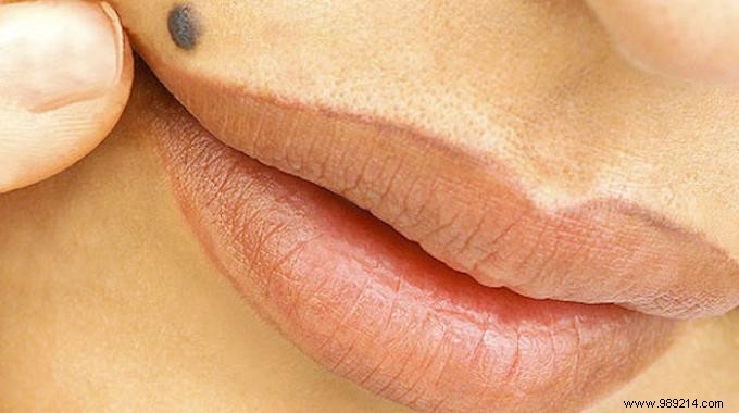 How to Lighten Upper Lip Peach Fuzz at Home with Hydrogen Peroxide