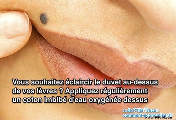 How to Lighten Upper Lip Peach Fuzz at Home with Hydrogen Peroxide