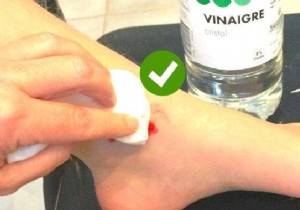 Heal Minor Cuts Fast with White Vinegar: A Trusted Home Remedy