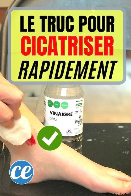 Heal Minor Cuts Fast with White Vinegar: A Trusted Home Remedy