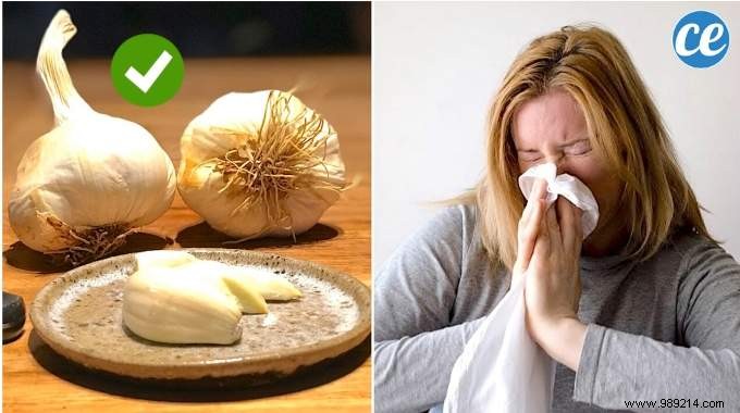 5 Time-Tested Garlic Remedies to Relieve Common Cold Symptoms