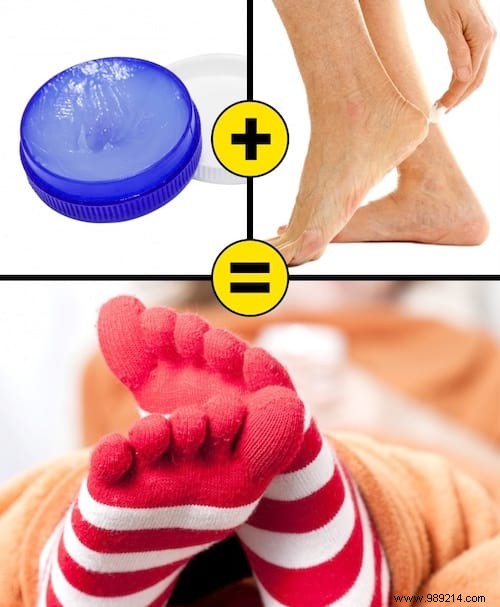 10 Proven Home Remedies for Dry, Cracked Heels: Restore Soft, Smooth Feet Naturally