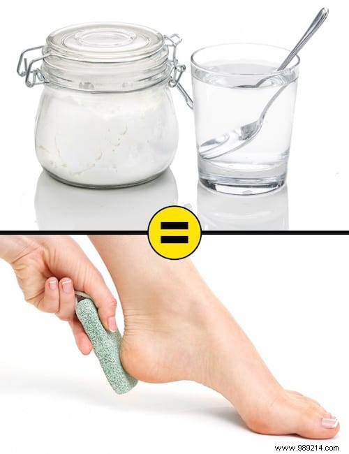 10 Proven Home Remedies for Dry, Cracked Heels: Restore Soft, Smooth Feet Naturally
