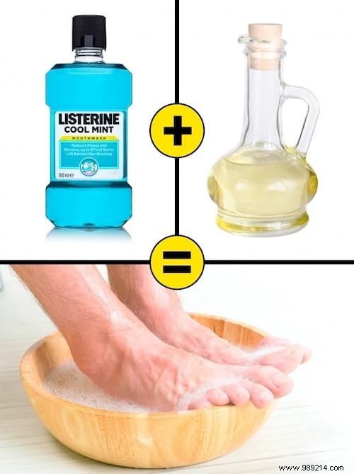 10 Proven Home Remedies for Dry, Cracked Heels: Restore Soft, Smooth Feet Naturally