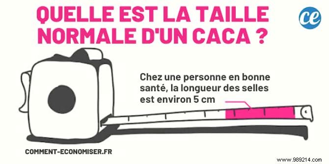 What Your Stool Reveals About Your Health: Color, Shape, Size, and Bristol Scale Explained