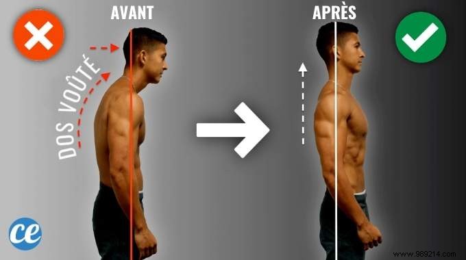 Fix Your Hunched Back: 6 Proven Exercises to Improve Posture