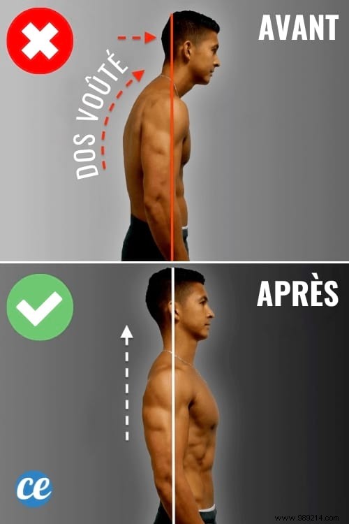 Fix Your Hunched Back: 6 Proven Exercises to Improve Posture