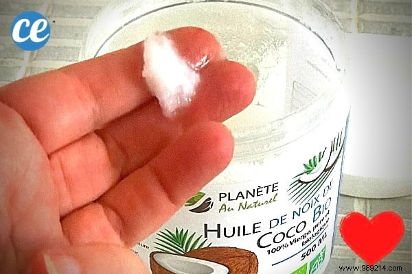 5 Expert-Approved Natural Lubricants from Your Home for Safe Intimacy