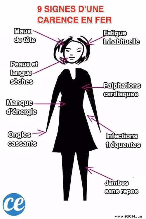 9 Key Signs of Iron Deficiency Anemia and How to Address Them