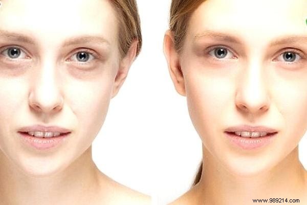 9 Key Signs of Iron Deficiency Anemia and How to Address Them