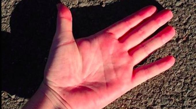 The 5-Second Hand Test: Is It Too Hot to Walk Your Dog?