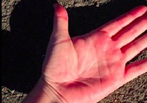 The 5-Second Hand Test: Is It Too Hot to Walk Your Dog?