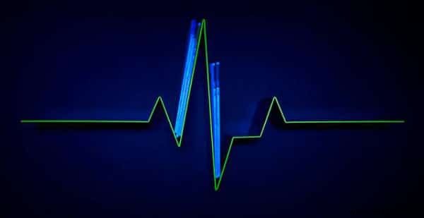 28 Ingenious Bookshelf Designs Every Book Lover Needs at Home