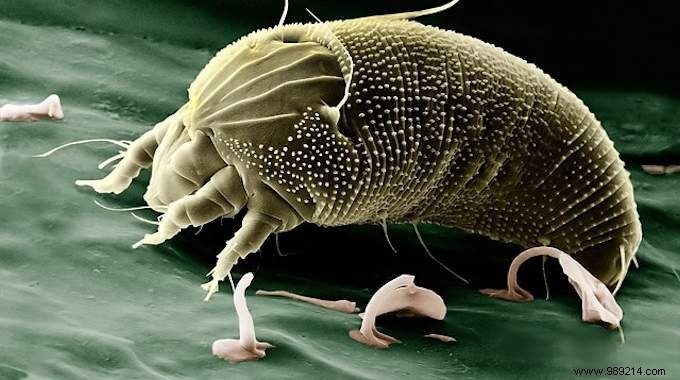 2 Proven Natural Ways to Eliminate Dust Mites from Your Bedding – Free and Effective