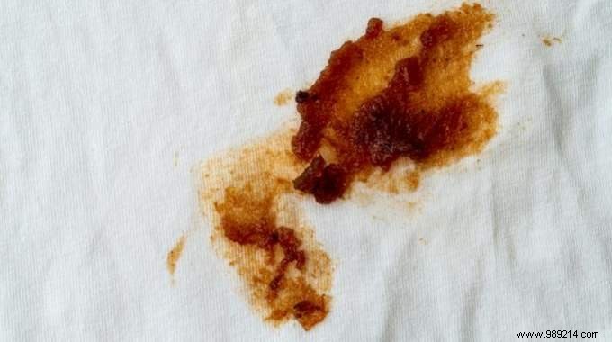 How Mir Dish Soap Banishes Tough Grease Stains from Clothes – My Proven Family Trick