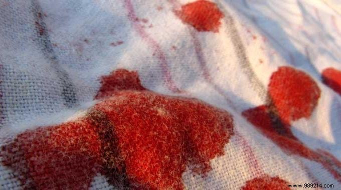 Proven Method to Remove Blood Stains from Clothes and Fabrics