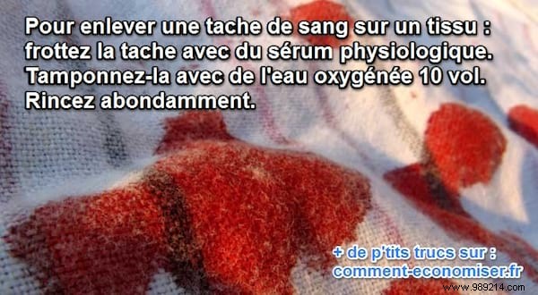 Proven Method to Remove Blood Stains from Clothes and Fabrics