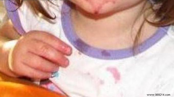 Proven Lemon Juice Method to Remove Red Fruit Stains from Clothes