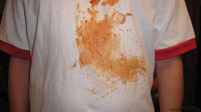 6 Proven Household Remedies to Remove Common Clothing Stains