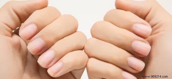 15 Ingenious Toothpaste Hacks for Cleaning, Beauty, and Home Repairs