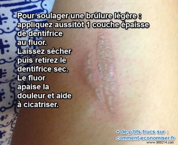 15 Ingenious Toothpaste Hacks for Cleaning, Beauty, and Home Repairs