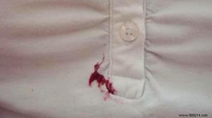 How to Remove Jam Stains from Clothes: A Proven, Easy Trick