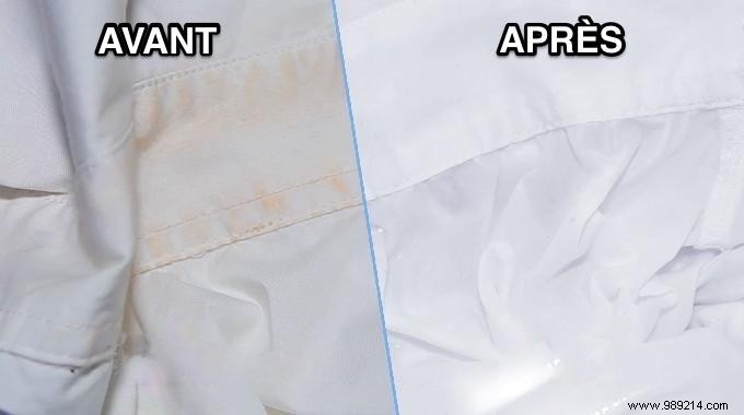 Grandma s Proven Stain Remover: Sodium Percarbonate for Spotless White Cotton