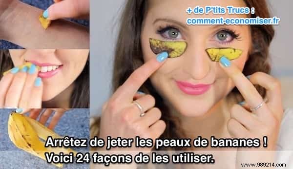 23 Proven Ways to Repurpose Banana Peels for Cleaning, Health, and Gardening