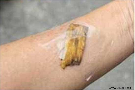 23 Proven Ways to Repurpose Banana Peels for Cleaning, Health, and Gardening