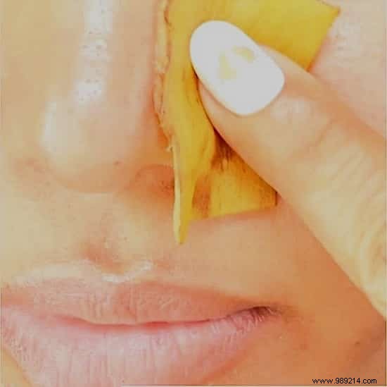 23 Proven Ways to Repurpose Banana Peels for Cleaning, Health, and Gardening