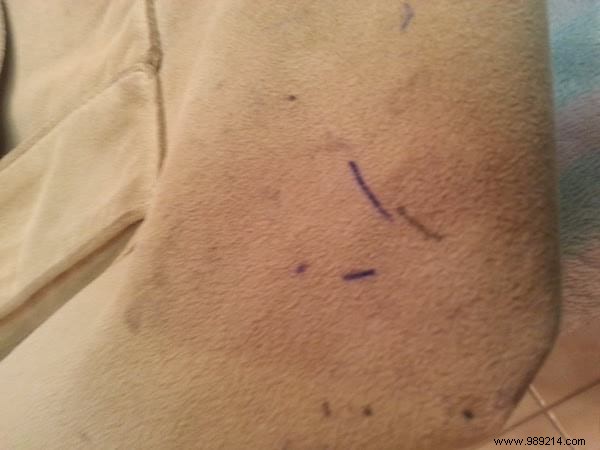 24 Proven Ways to Remove Ink Stains from Clothes, Leather, Carpets, and More