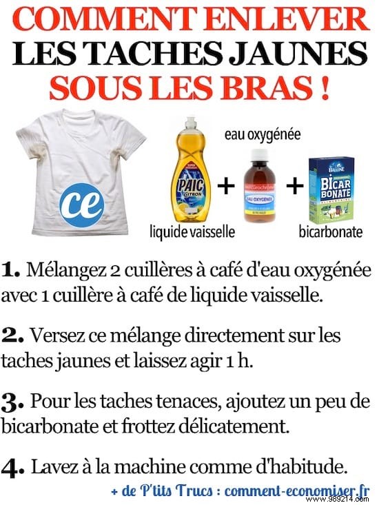 Remove Yellow Armpit Stains from White Clothes: Grandma s Proven Home Remedy