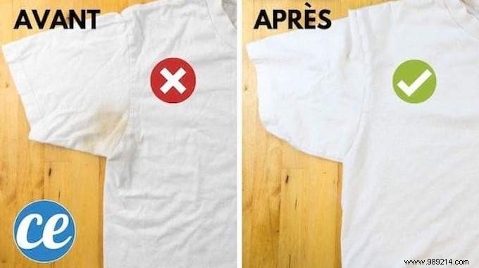 Remove Yellow Armpit Stains from White Clothes: Grandma s Proven Home Remedy