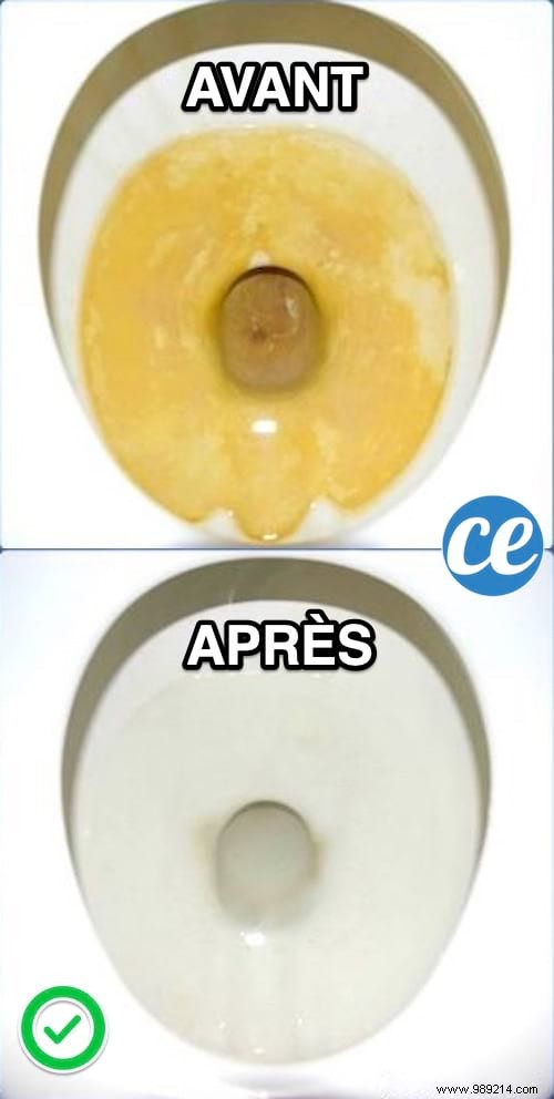 Ultimate Natural Toilet Bowl Cleaner: Erase Limescale Stains Effortlessly