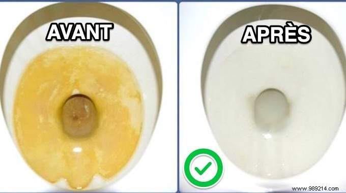 Ultimate Natural Toilet Bowl Cleaner: Erase Limescale Stains Effortlessly