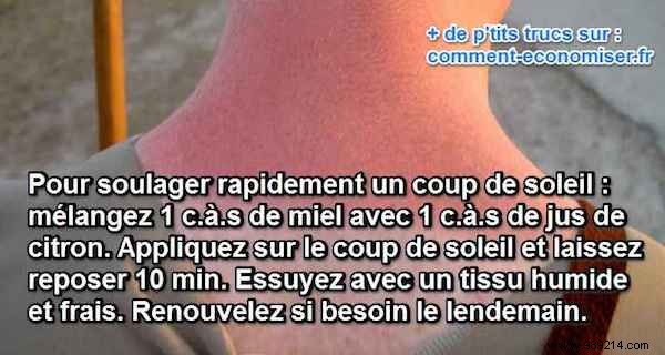 15 Proven Home Remedies to Soothe Sunburn Pain Fast – No Biafine Needed