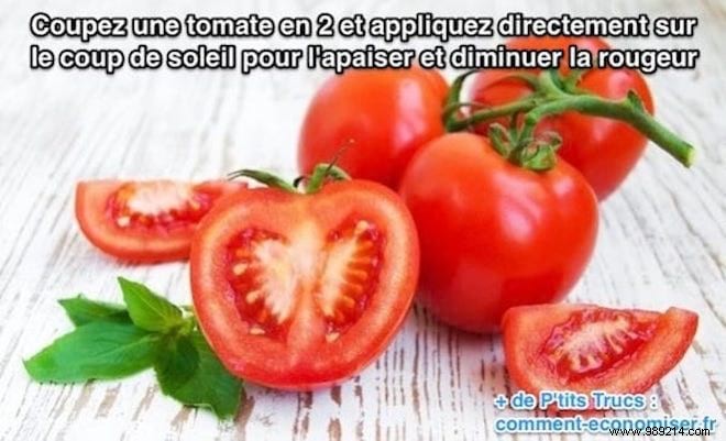 15 Proven Home Remedies to Soothe Sunburn Pain Fast – No Biafine Needed