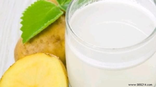 15 Proven Home Remedies to Soothe Sunburn Pain Fast – No Biafine Needed