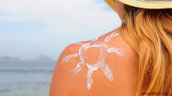 15 Proven Home Remedies to Soothe Sunburn Pain Fast – No Biafine Needed