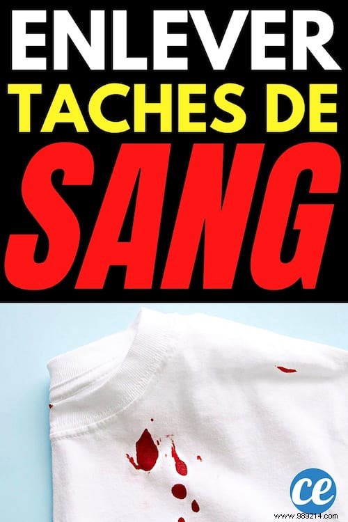 7 Proven Tips to Remove Blood Stains from White Clothes Effortlessly