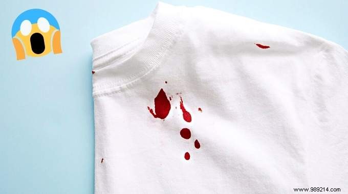 7 Proven Tips to Remove Blood Stains from White Clothes Effortlessly
