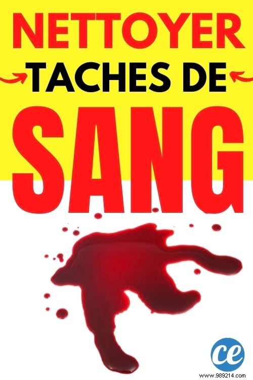 7 Proven Tips to Remove Blood Stains from White Clothes Effortlessly