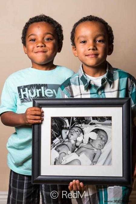17 Heartwarming Before-and-After Photos of Preemies Holding Their Newborn Pictures