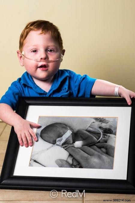 17 Heartwarming Before-and-After Photos of Preemies Holding Their Newborn Pictures
