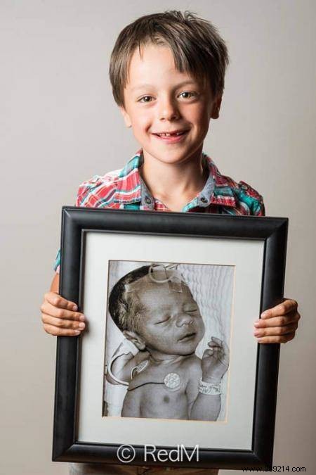17 Heartwarming Before-and-After Photos of Preemies Holding Their Newborn Pictures