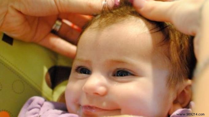 Grandma s Proven Natural Remedy: Remove Baby Cradle Cap with Sweet Almond Oil