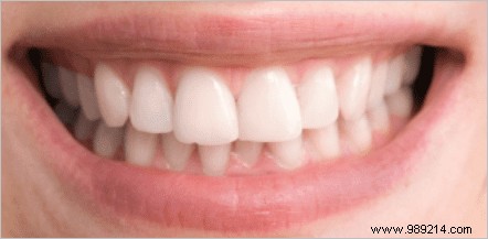 How to Configure Remote Desktop for Multiple Computers on Your Network