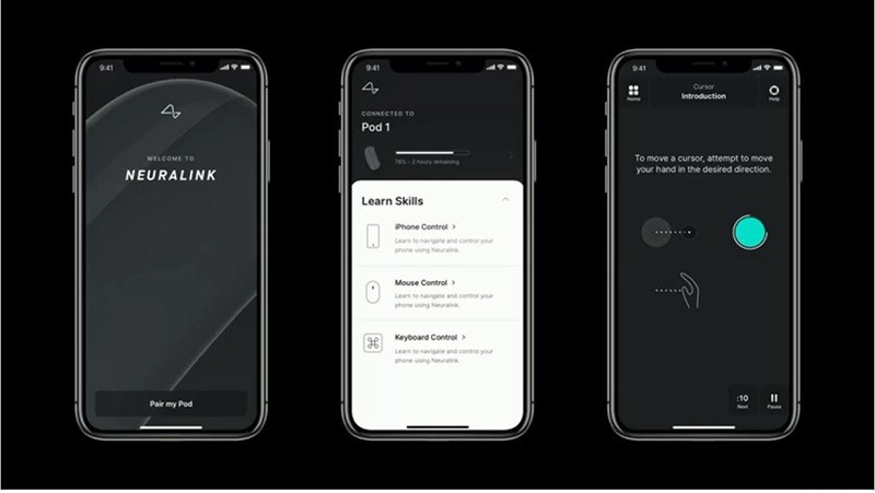 Brain-Computer Interfaces: What They Are and Why They re Captivating the World Now