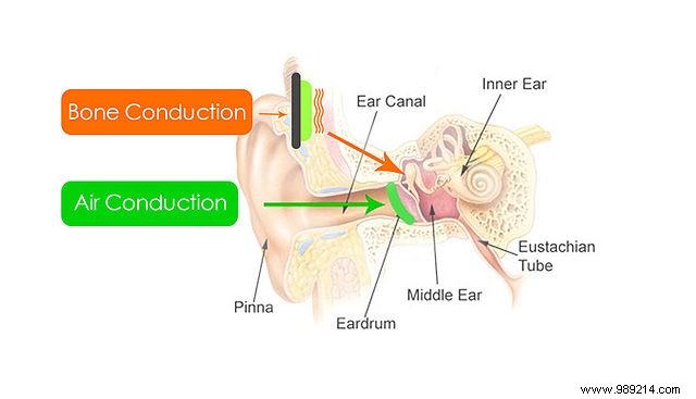 Bone Conduction Technology: How It Works and Real-World Applications